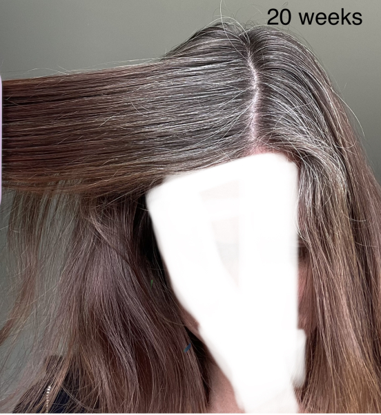 Join the grey transition