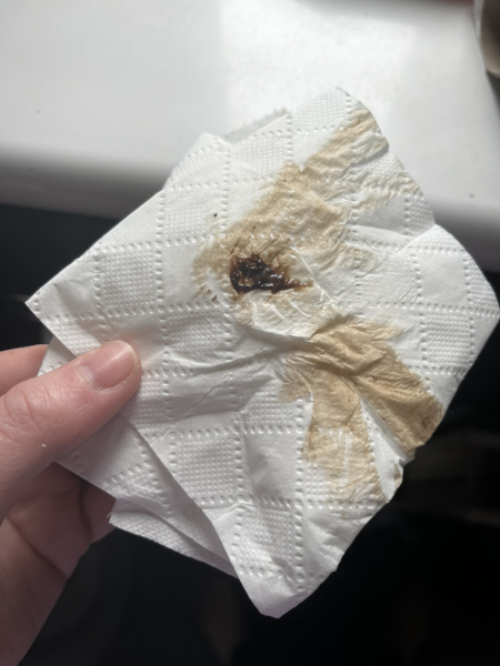 Pregant after miscarriage - support thread