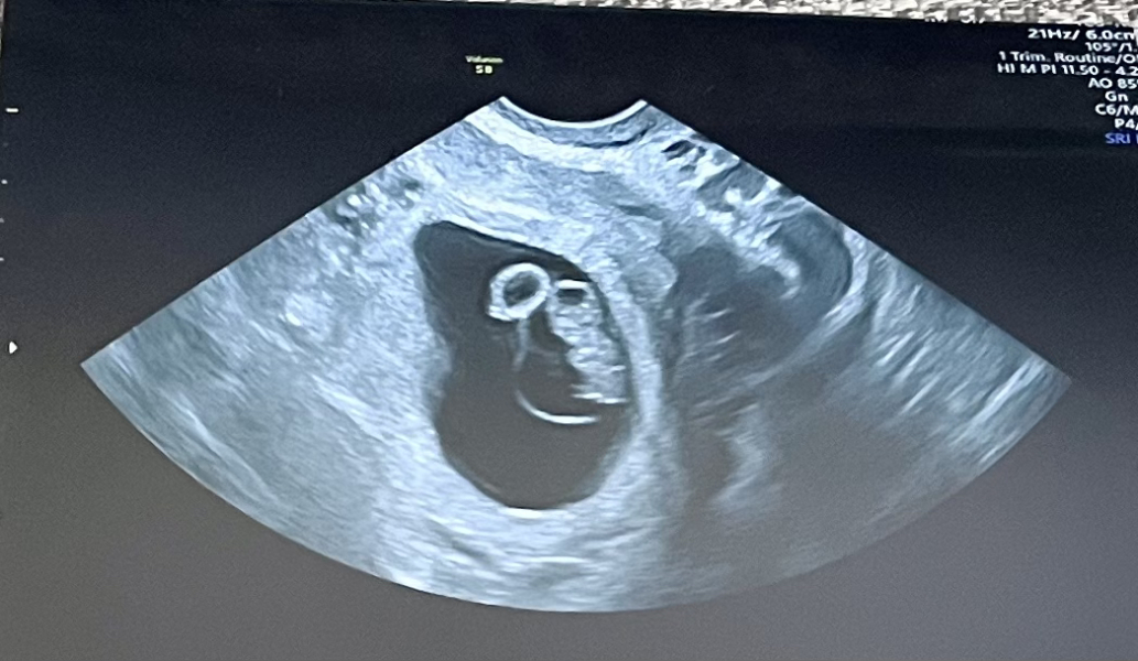 Due January 2024 🎉 PART 2