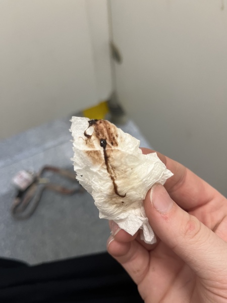 Brown clot and blood at 11+4 