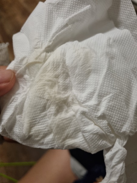 TMI amniotic fluid??