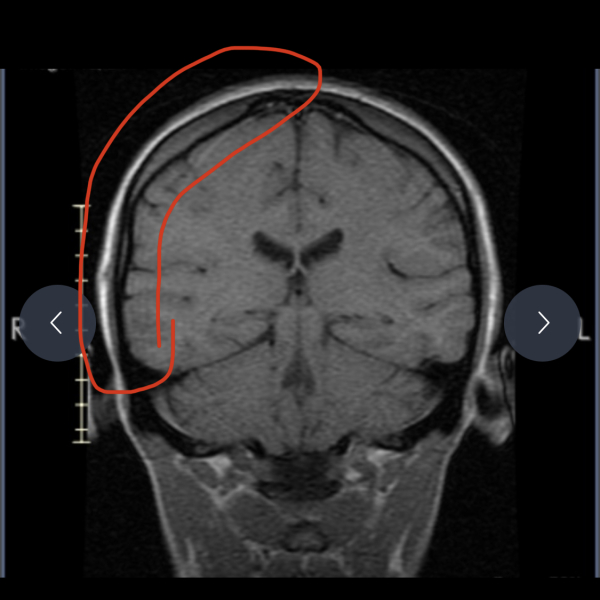 Brain scan - what is this??