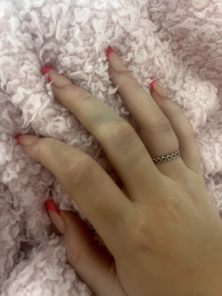 What's wrong with my hands / arms? (Pics included)