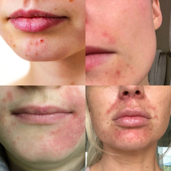Doctors don’t know what’s wrong with DS’s face. Can the MN hive mind help?