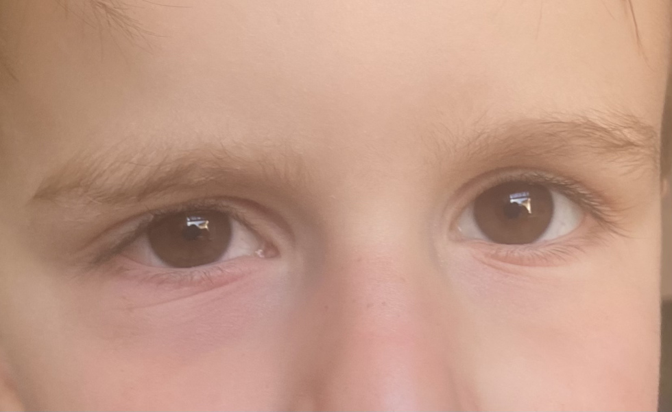Is this hay fever?