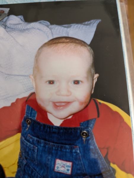 Doctors don’t know what’s wrong with DS’s face. Can the MN hive mind help?