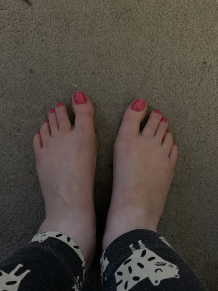 Show me a pic of your bunions…