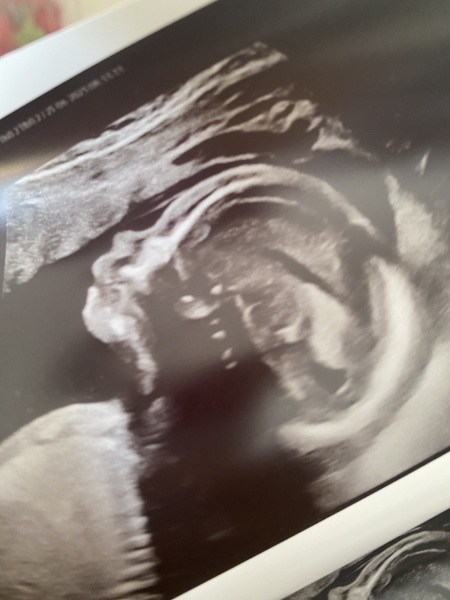 TWW - Testing Around 1st March 