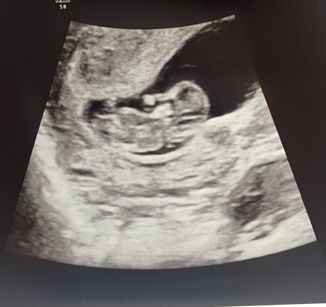 Due January 2024 🎉 PART 3