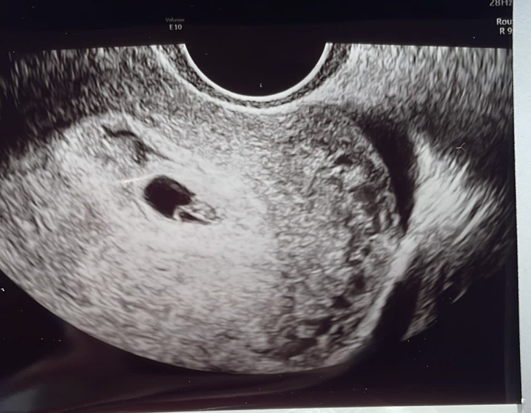Due January 2024 🎉 PART 2