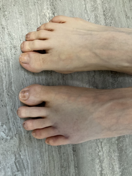 Do I need to get it checked out? (Photo)