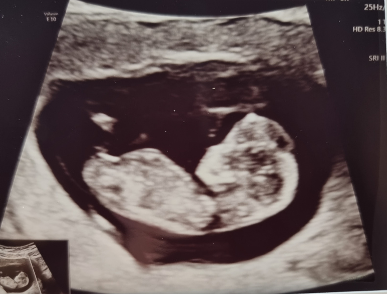 Due January 2024 🎉 PART 3