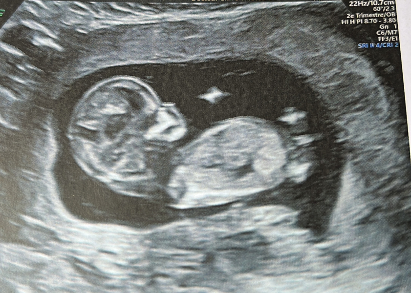 Due January 2024 🎉 PART 3