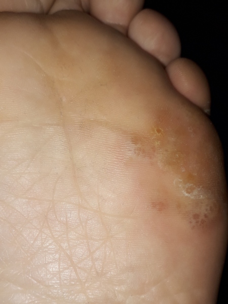 WTH is wrong with my foot?