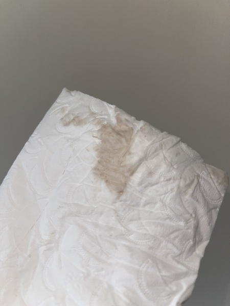 Has anyone experienced this? (Picture included)