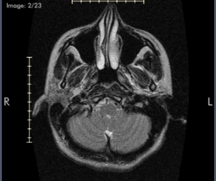 Brain scan - what is this??