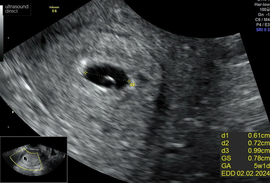 Due February 2024!
