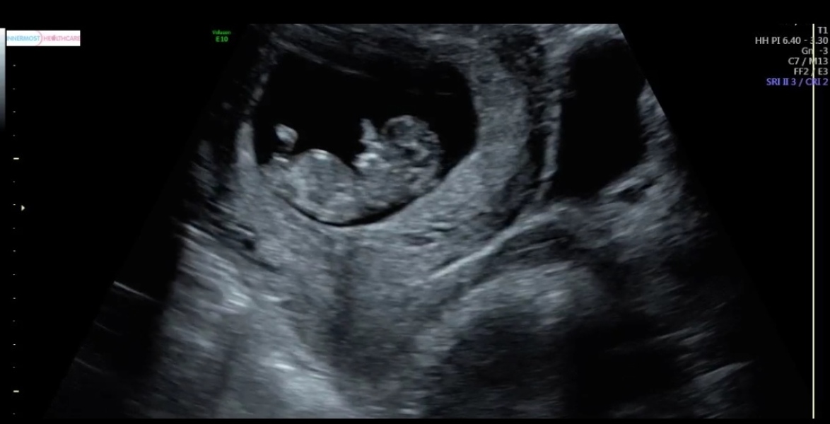 Gender guess from a scan photo - how?