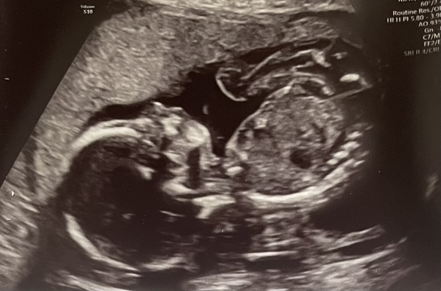 Due October 2023 - thread 7