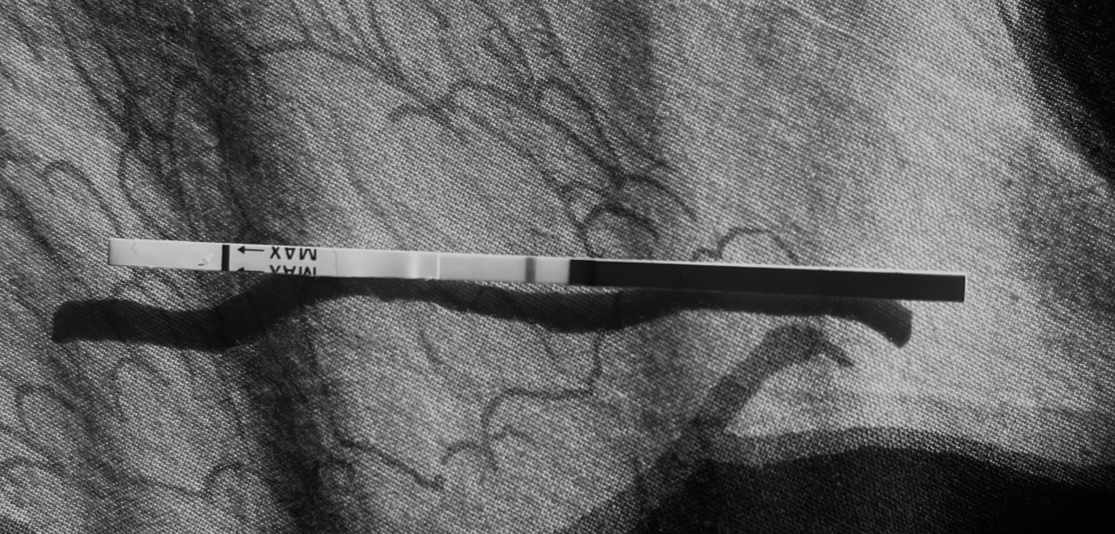 1dpo club !