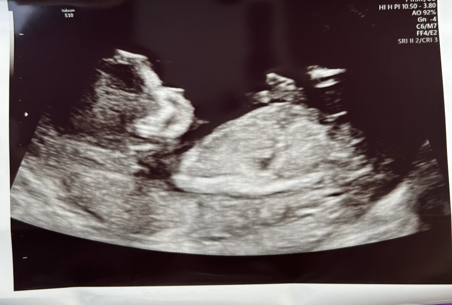 Due January 2024 🎉 PART 3