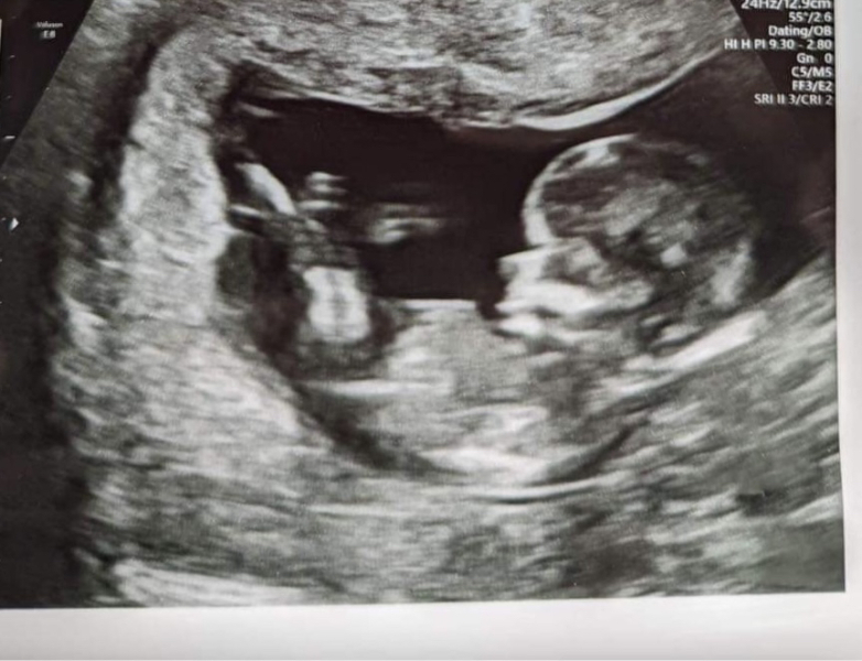 Due December 2023 part 3