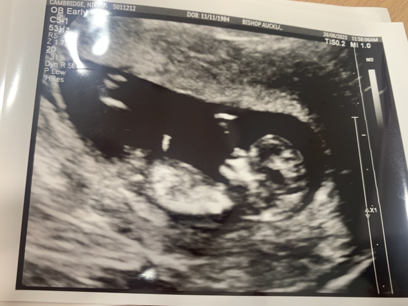 Due January 2024 🎉 PART 3