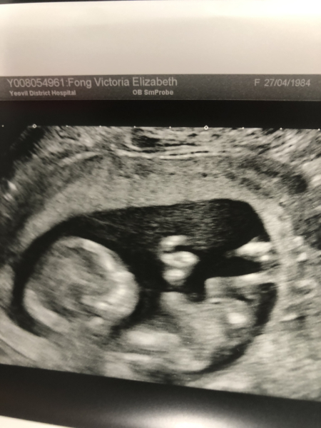 Due January 2024 🎉 PART 3