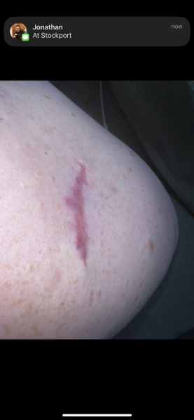 Son won’t wear sun screen - should I give up? :( 