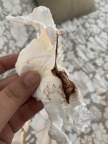 Implantation bleeding? 