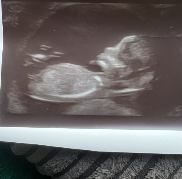 Due January 2024 🎉 PART 3