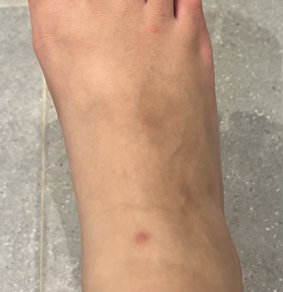 Skin problems 