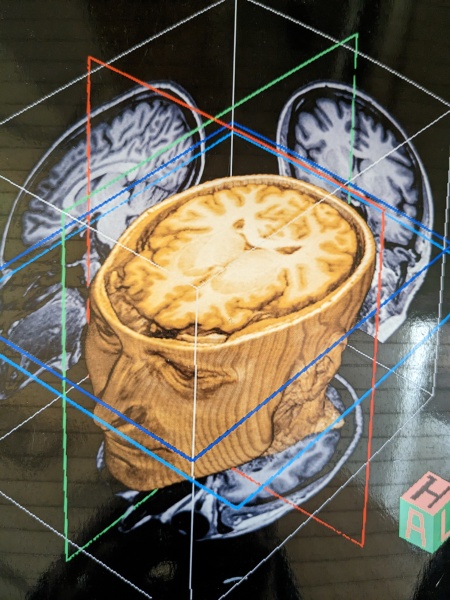 Brain scan - what is this??