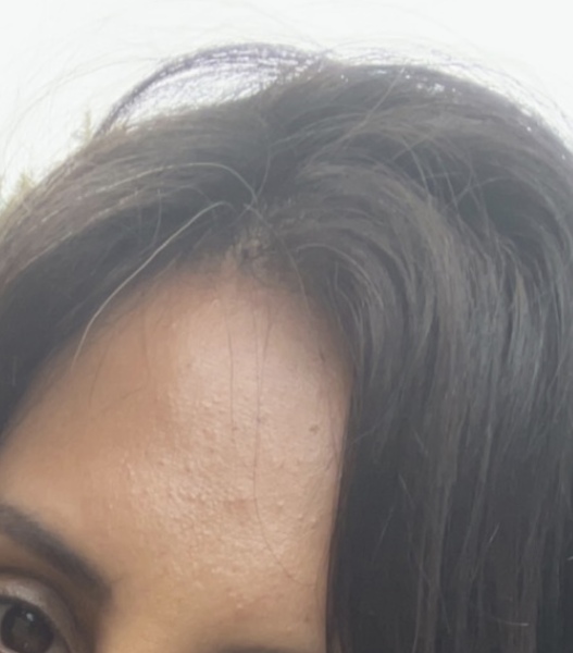 What are these spots on my face? 