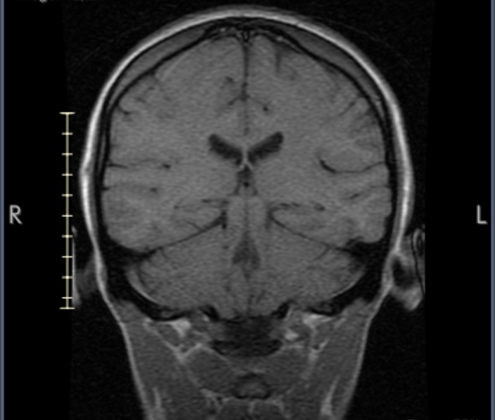 Brain scan - what is this??