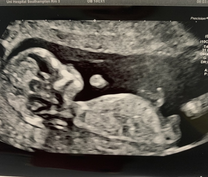 Gender guess please 