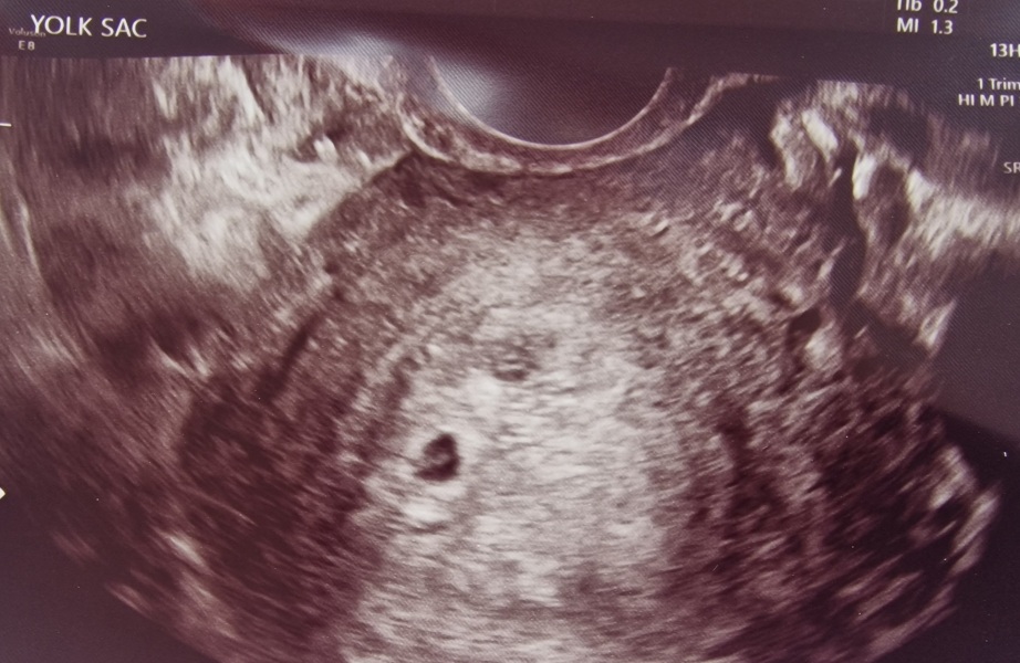 Due February 2024!