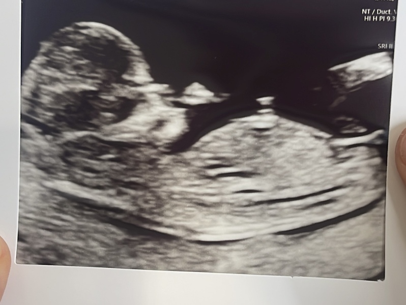Due January 2024 🎉 PART 3