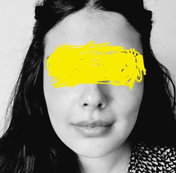 What has happened to face! Pic included