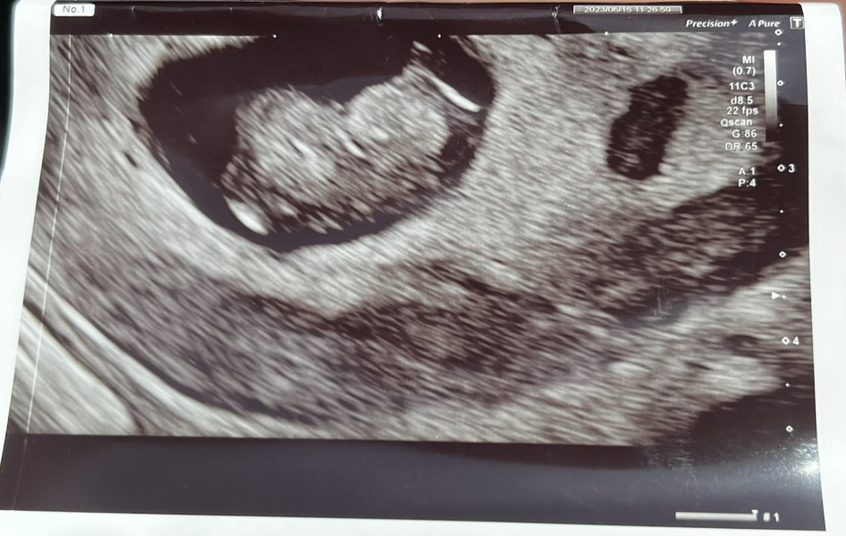 Due January 2024 🎉 PART 3