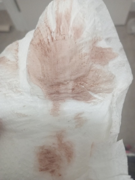 Period or implantation bleeding?