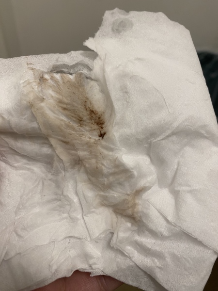 Implantation bleeding? 