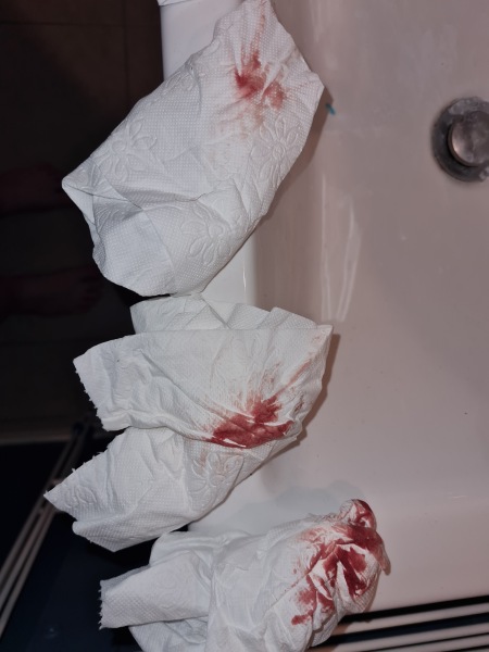 5 weeks + 2 bleeding after FET