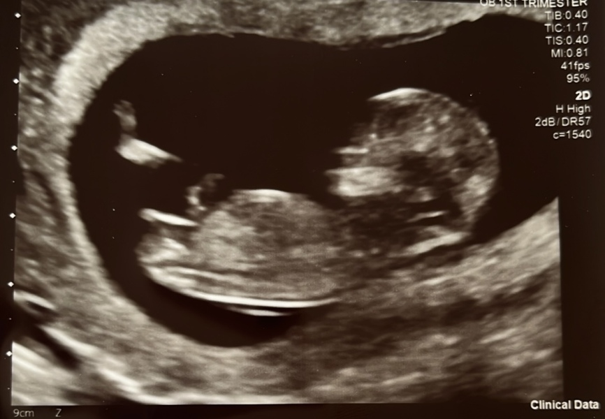 Nub theory prediction wrong?