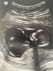 Nub Theory 14 weeks.