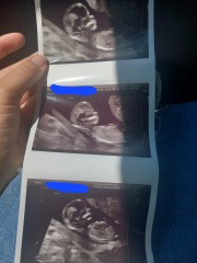 13 weeks pregnant and gender confusion