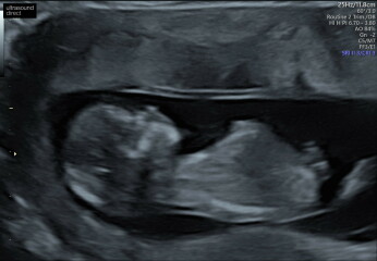 Due December 2023 part 3