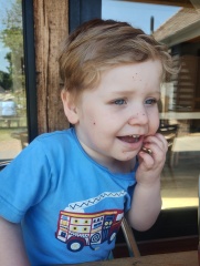 ? Rash, surely not chicken pox?