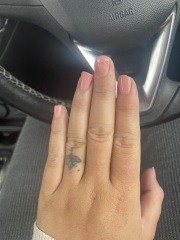 Line on nail skin c advice