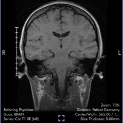 Brain scan - what is this??